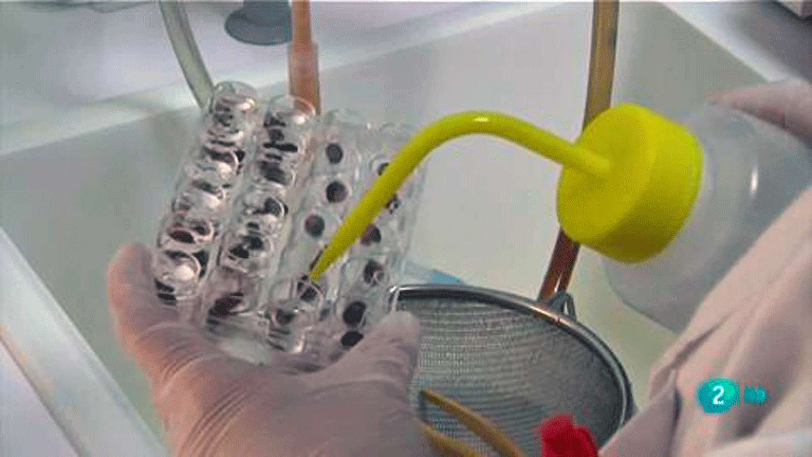 La aventura del saber. Universo Sostenible 2: Enfermedades tropicales