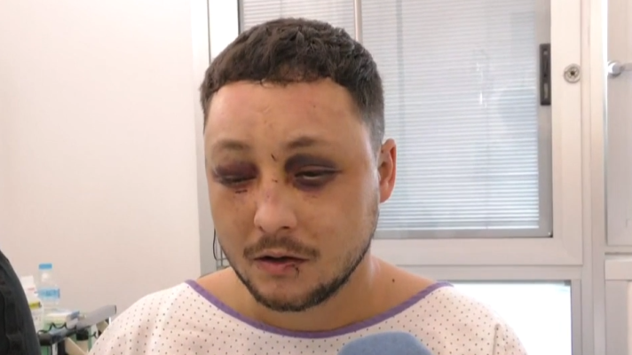 Telediario 1 - Ingresado en el hospital tras defender a una joven que estaba siendo agredida por su pareja