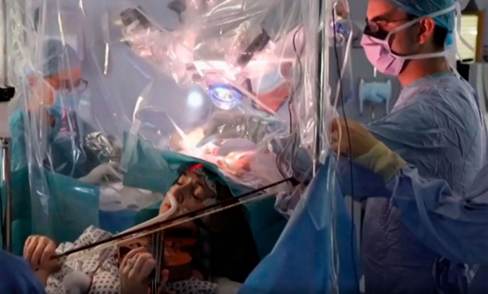 Le extirpan más del 90 % de un tumor cerebral mientras toca el violín -RTVE.es - Modo Digital | Ver