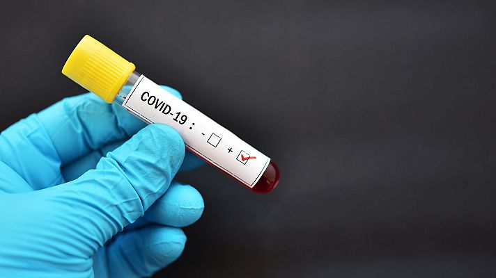 Telediario 1 - China descubre la vía de entrada del coronavirus
