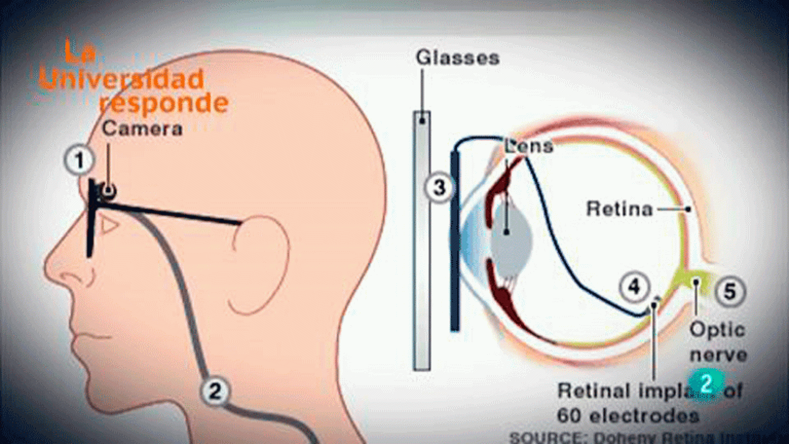 La aventura del saber ¿Puede la cámara de fotos sustituir al ojo humano? Universidad de Zaragoza. La Universidad Responde.