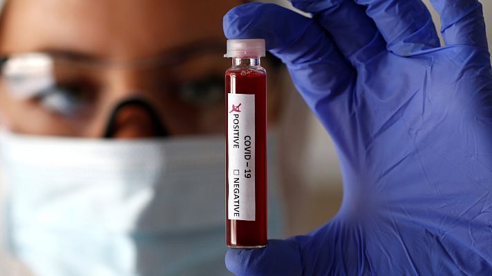 Telediario 1 - Coronavirus | Sanidad hará más test porque solo en Madrid hay más de 20.000 casos sospechosos