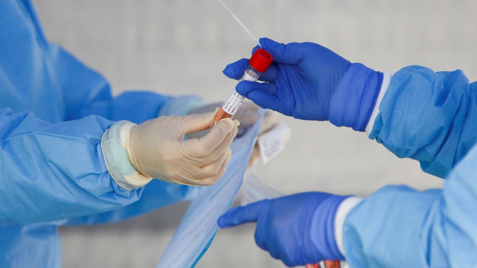 Coronavirus: Sanidad compró 58.000 test defectuosos en China | Ver