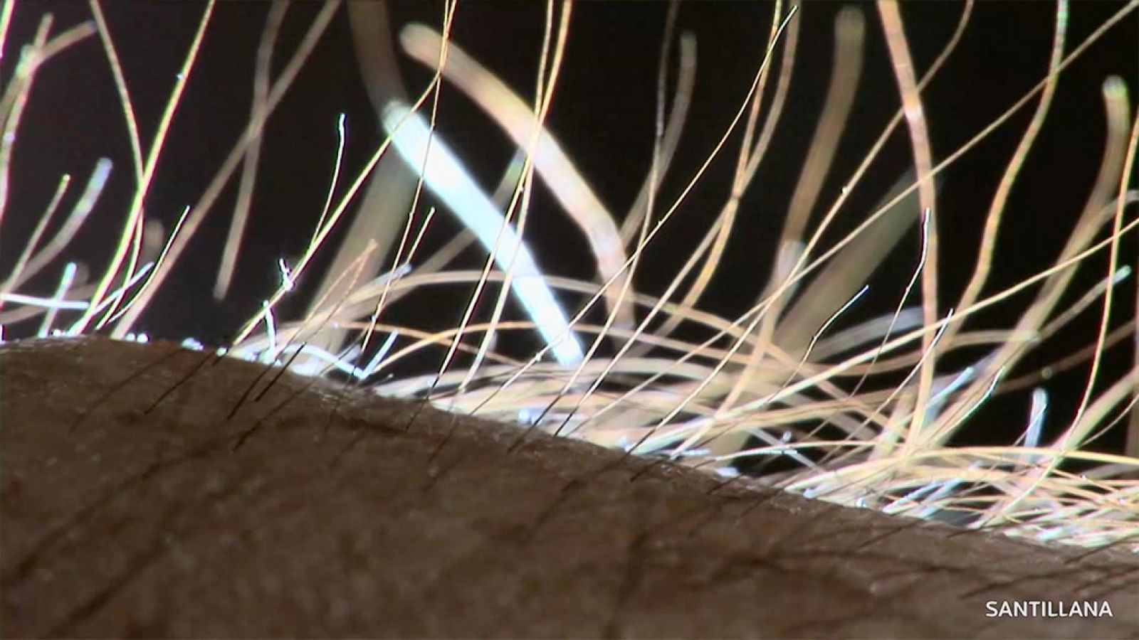 CIENCIAS NATURALES - Nuestra piel - EduClan 9 a 10 años | Ver