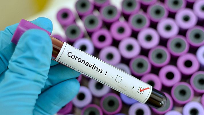 Telediario 1 - Las palabras de una pandemia