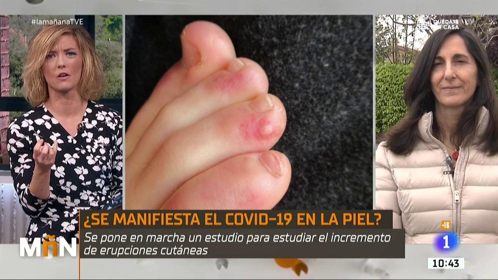 La Mañana - ¿Puede afectar el coronavirus a la piel?