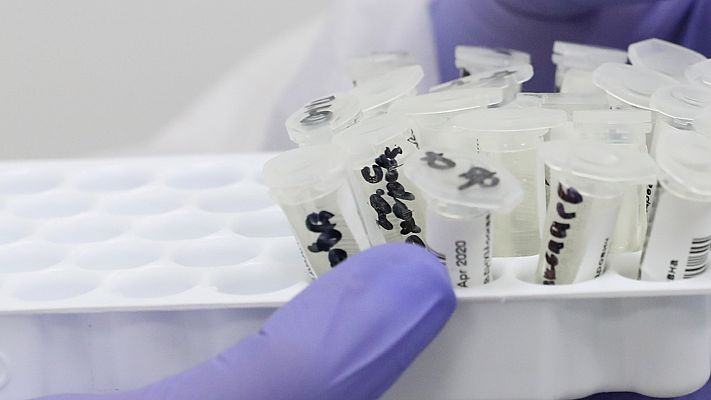 Informativo 24h - Simón: "Los que dan positivo al tests son un 3,1%"