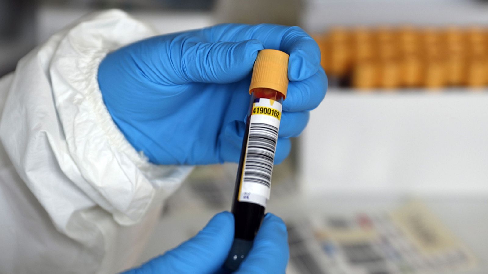 Coronavirus | Sanidad inicia los test de detección en casos sospechosos - Especiales informativos | Ver