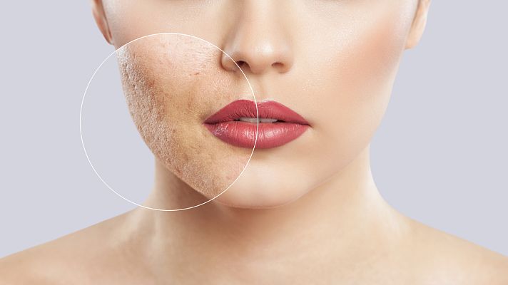 Comando Actualidad - Así está afectando el confinamiento a nuestra piel