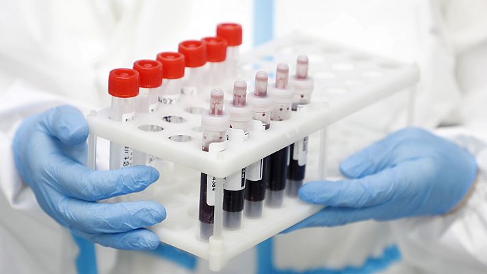 Especial Coronavirus - La edad media de contagios de Covid-19 en España desciende de los 62 a los 52 años