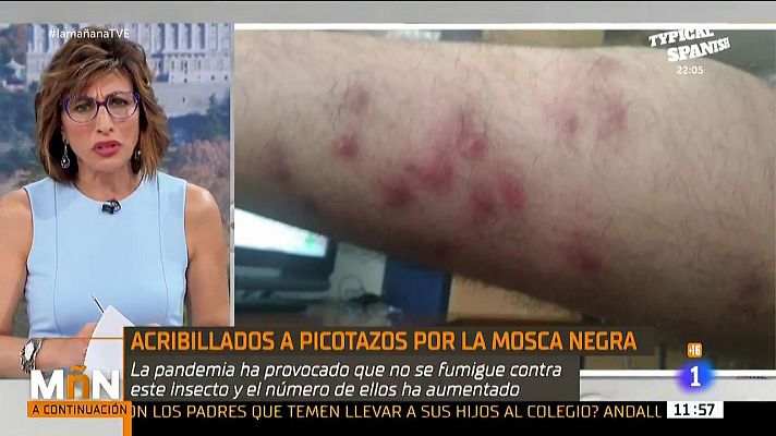 La mañana - La mosca negra amenaza más que nunca tras la pandemia