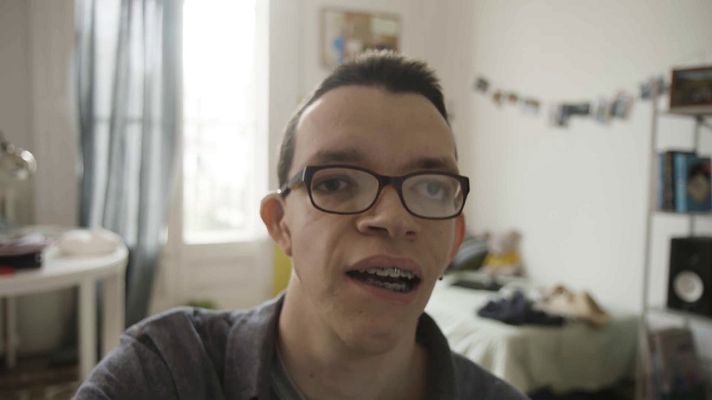 Para todos La 2 - Síndrome Treacher Collins. Enfermedad minoritaria