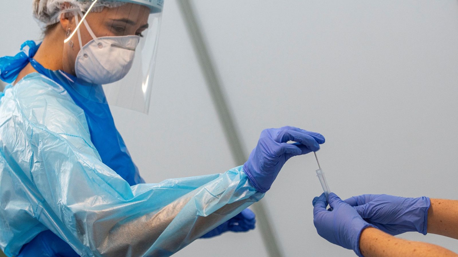 Covid persistente, síntomas que duran meses con PCR negativas