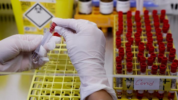 Telediario 1 - Los anticuerpos contra el coronavirus podrían durar siete meses, según un estudio