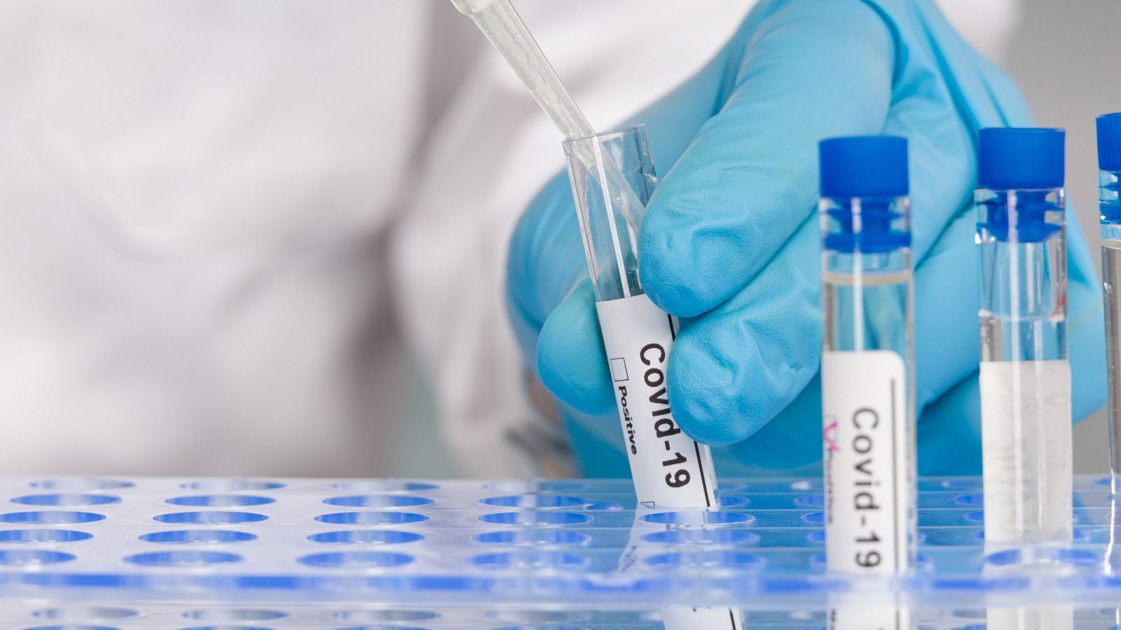 Nuevo test de anticuerpos con una fiabilidad de casi el 100% - La hora de La 1 | Ver