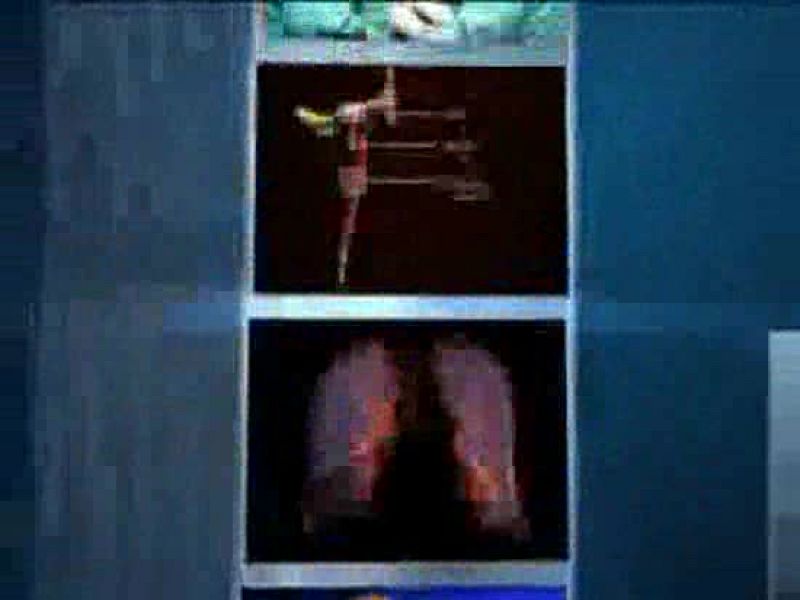 Aumentan las pulsaciones en los corredores de encierros en cuatro segundos | Ver