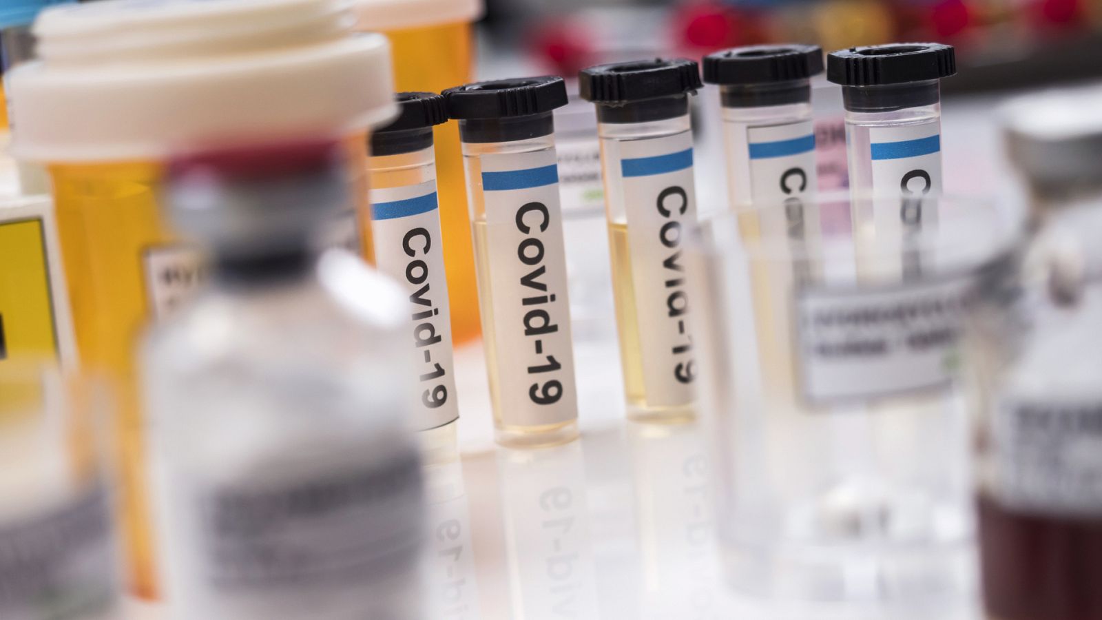 España Directo - ¡Test de anticuerpos en dos semanas!