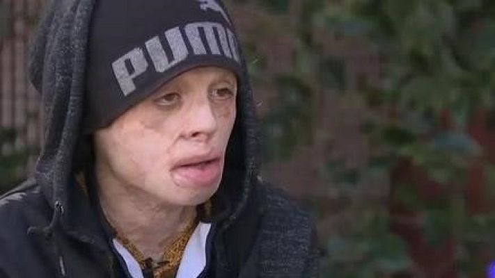 Telediario 1 - "El niño de fuego", cuando la música alivia el dolor