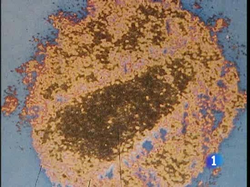 La vacuna contra el sida, un poco más cerca - Ciencia y tecnología en Rtve.es | Ver