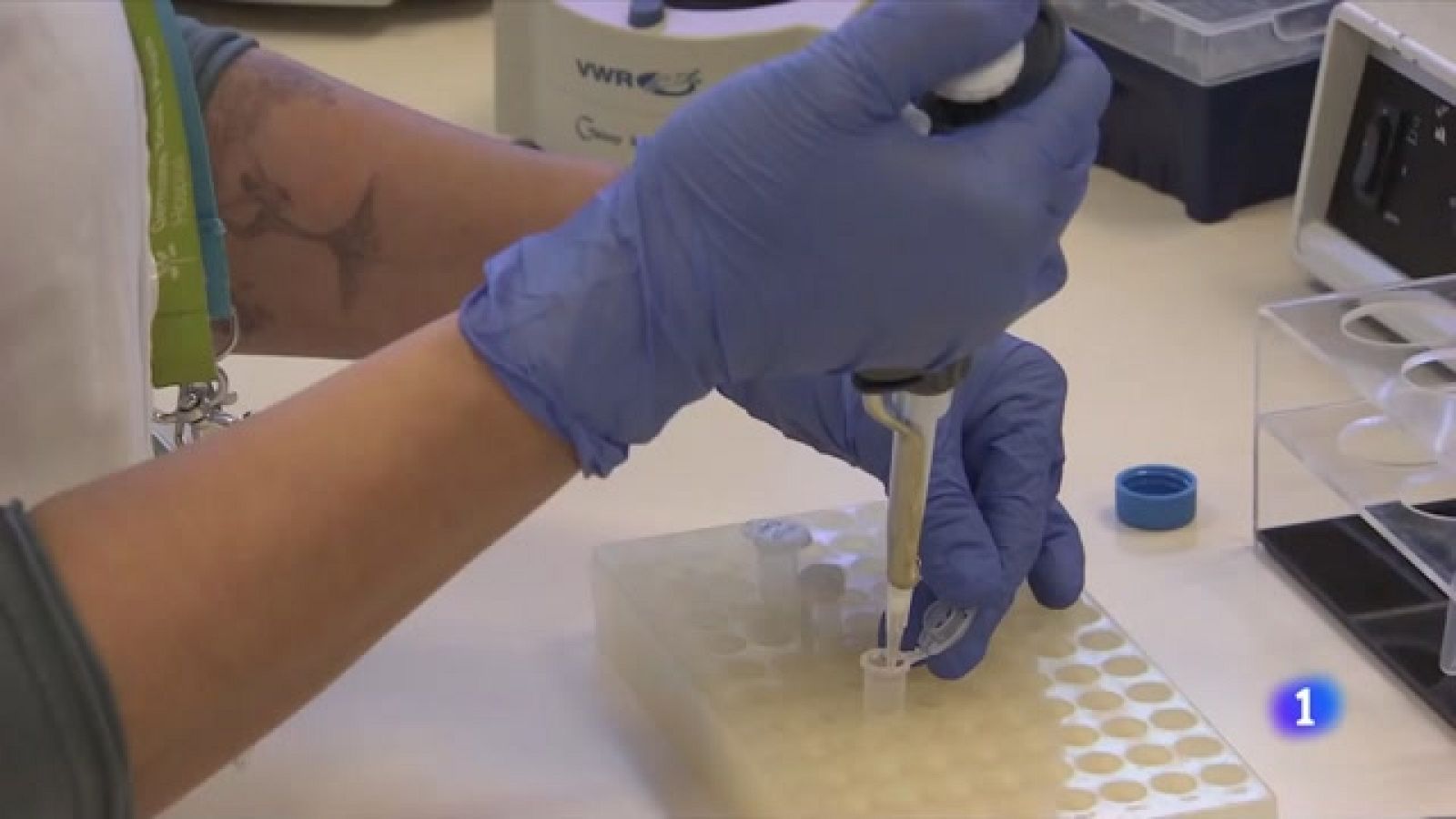 Una vacuna contra el VIH millora el seu control