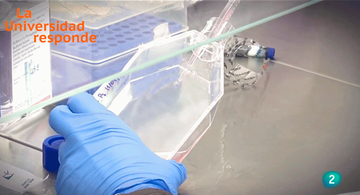 La aventura del Saber - ¿Se puede prevenir el alzheimer?