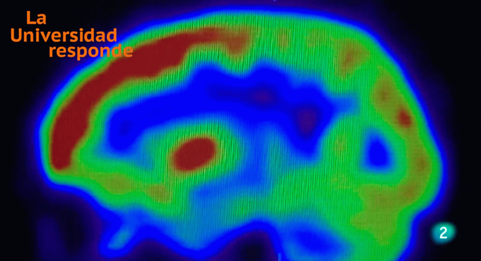 La aventura del saber tan solo usamos  un 10% del cerebro UNED universidad Responde #AventuraSaberUResponde