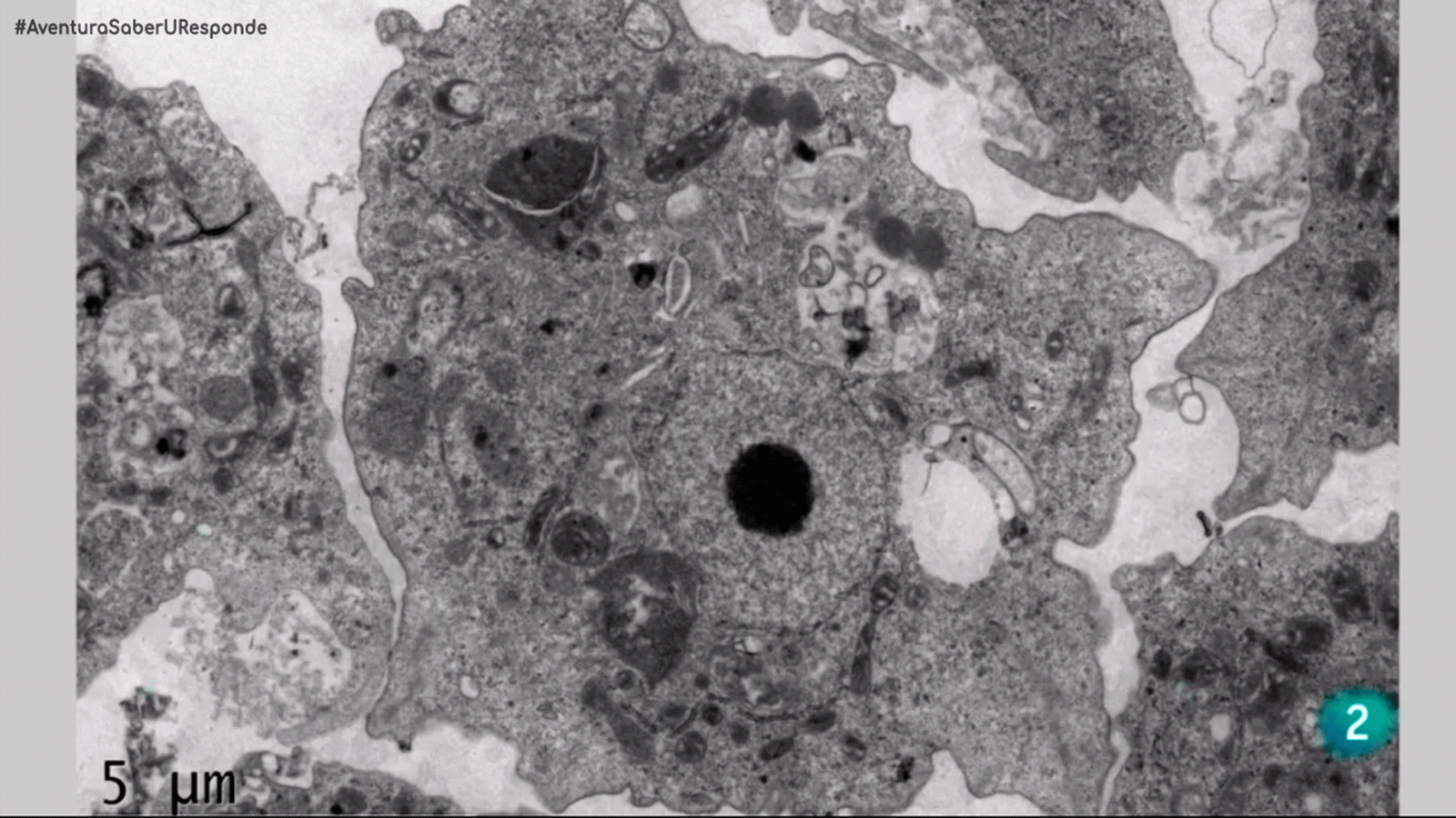 La aventura del saber las amebas de vida libre La Laguna Universidad Responde crue #AventuraSaberUResponde