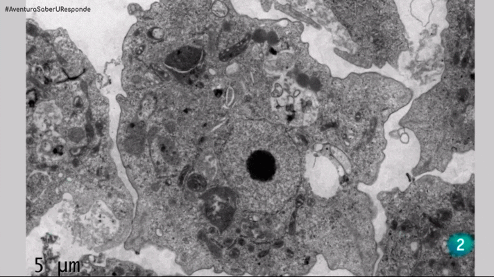 La aventura del Saber - ¿Qué son las amebas de vida libre?