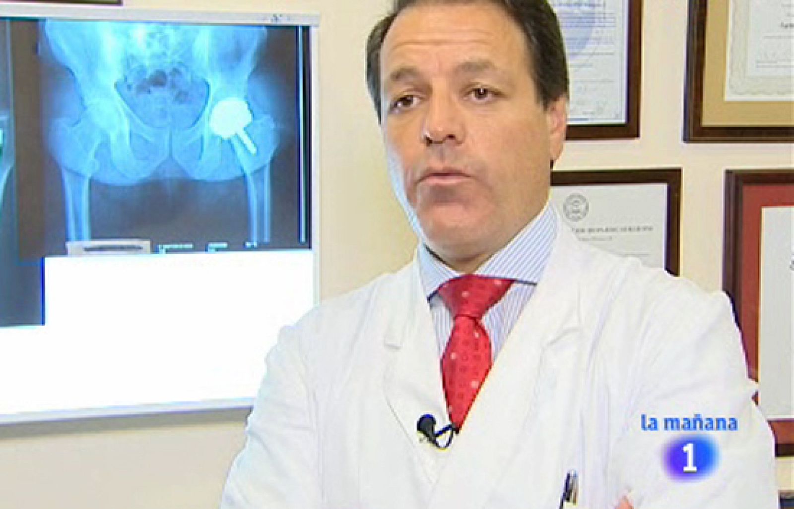 Saber vivir - Prótesis articulares | Ver