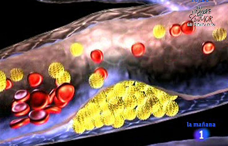 Saber vivir - El colesterol
