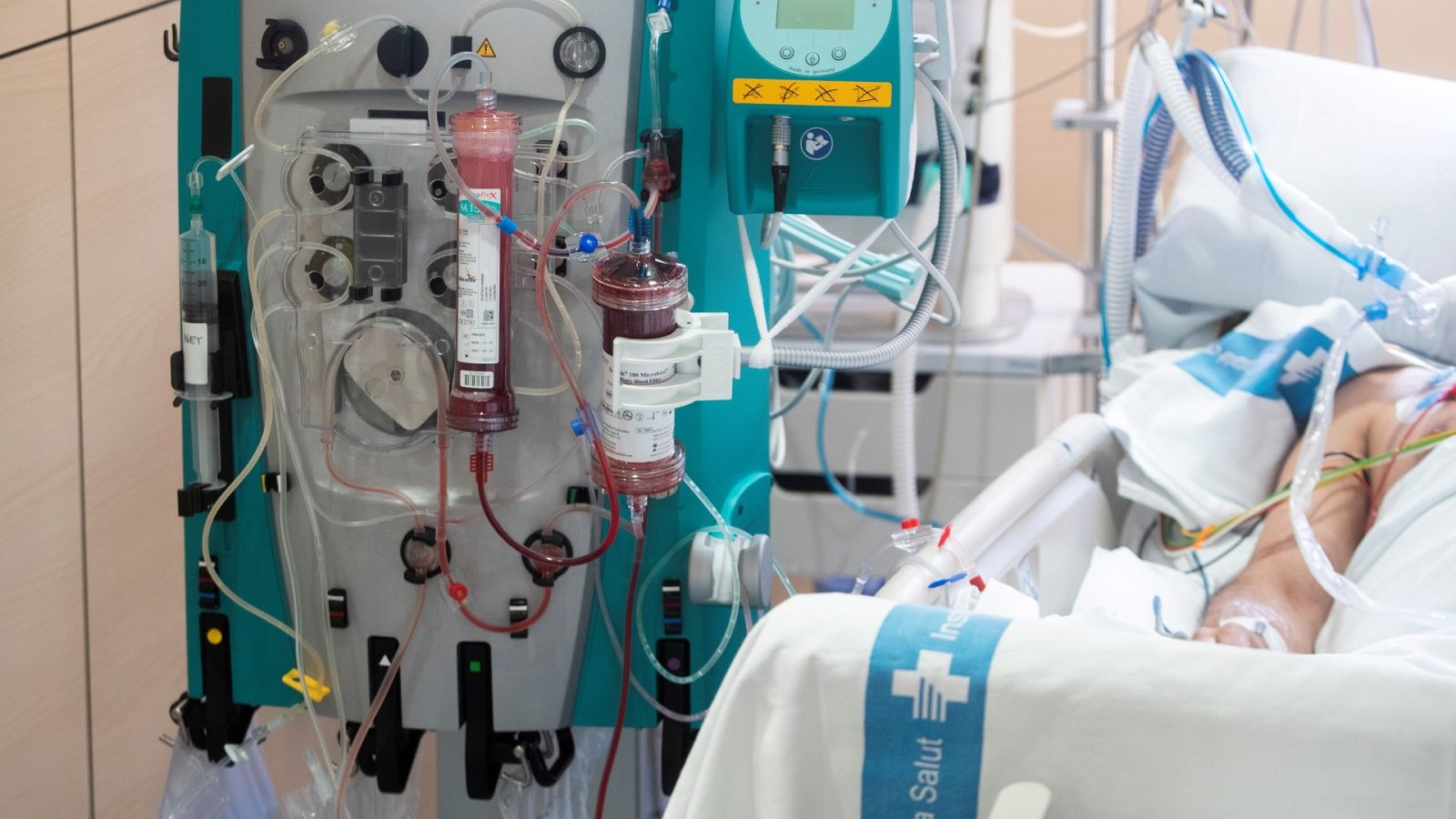 Colocar a los pacientes graves de COVID-19 boca abajo mejora su pronóstico y es menos invasivo, según un estudio