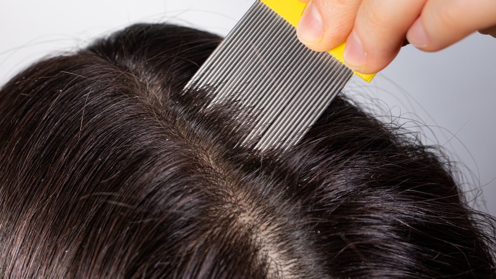 Consejos para evitar los piojos con la vuelta al cole