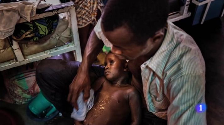 L'Informatiu - La memoria del olvido: un llibre de relats sobre epidèmies, guerres i pobresa