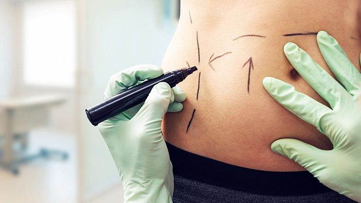 Mejor contigo - ¿Qué famosa se ha arrepentido recientemente de una operación estética?