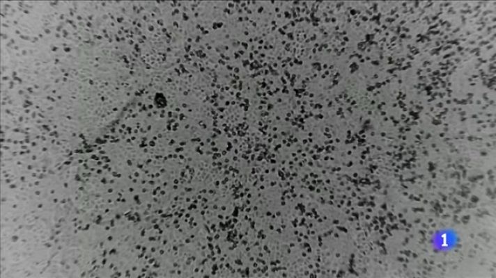 Telediario Fin de Semana - Habrá brotes puntuales y medidas localizadas