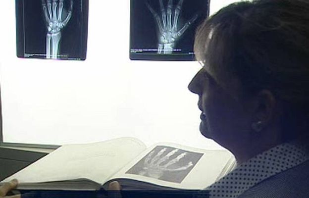 Ciencia y tecnología en Rtve.es - ¿Cómo averigua un forense la edad?