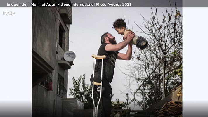 Telediario 2 - Italia se ofrece a tratar a Mustafá, el niño sirio que nació sin extremidades por culpa de la guerra