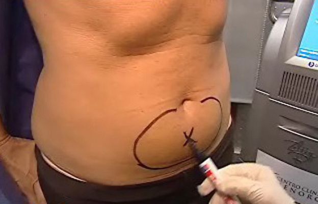 España Directo - Dieta del frío o calor