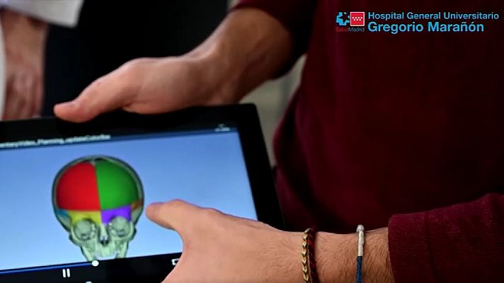 Telediario 1 - El Hospital Gregorio Marañón comienza a utilizar la realidad aumentada en sus quirófanos