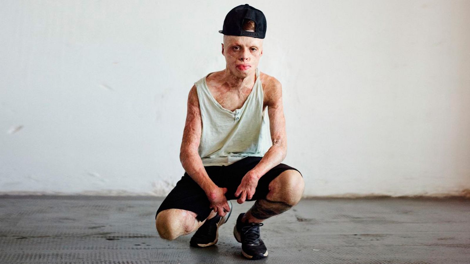 Somos documentales - El niño de fuego - Ver ahora