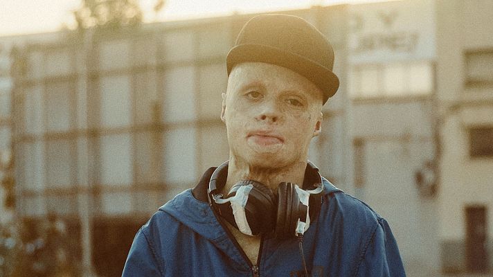 Somos Documentales - 'El niño de fuego': estreno el 16 de diciembre en RTVE Play