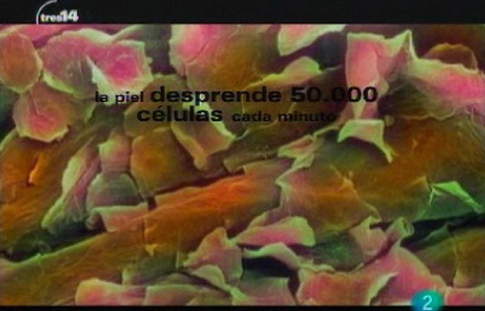 Y además (piel)