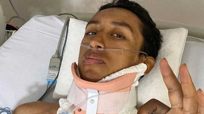 Telediario 1 - Egan Bernal tendrá que volver a operarse de la columna