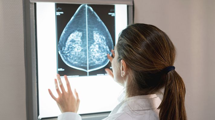 Telediario 1 - Un fármaco, eficaz contra la metástasis del cáncer de mama