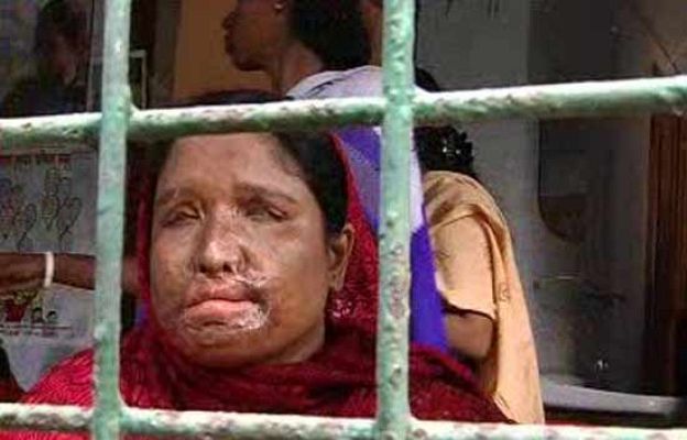  - Mujeres atacadas con ácido