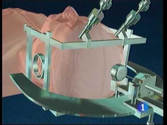 Ciencia y tecnología en Rtve.es - Borrar los malos recuerdos