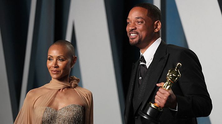 Telediario 1 - La agresión de Will Smith a Chris Rock en los Oscar también pone el foco en la alopecia femenina
