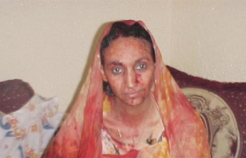 Aminatu Haidar fue torturada por la policía marroquí en 2005. Las imágenes, que entonces dieron la vuelta al mundo, ahora son recordadas cuando se cumple un mes de su huelga de hambre.