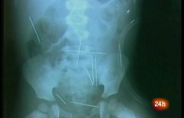  - ¿Víctima de un ritual?