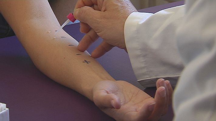 Noticias Andalucía - Alergias en primavera